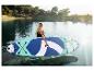 Žena s paddleboardom na jazere, obklopená stromami.